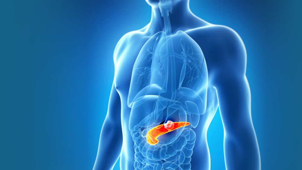 Pankreas Kanserinde Yeni Umut: Fosfor 32
