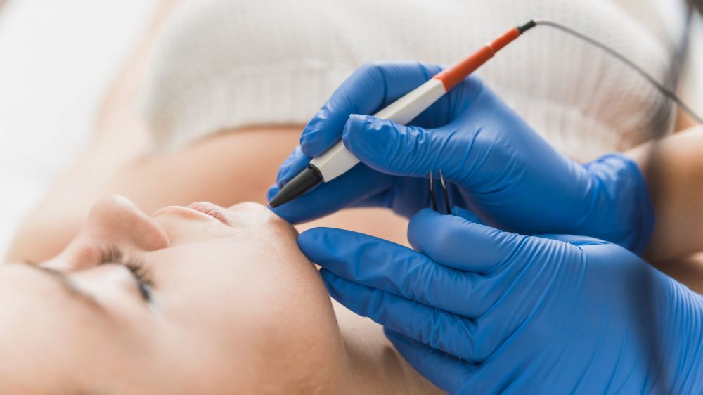 Yanlış Epilasyon Uygulamalarına Dikkat