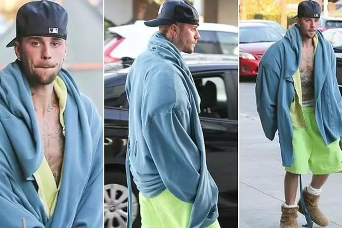 Justin Bieber’ın üstsüz ve dağınık görüntüsü hayranlarını endişelendirdi