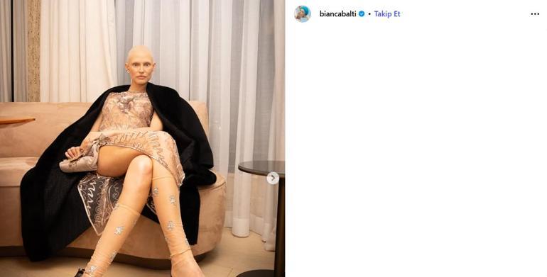 Kanserle mücadele eden eski Victoria's Secret modeline şirketten şoke eden cevap! Dünya konuşuyor