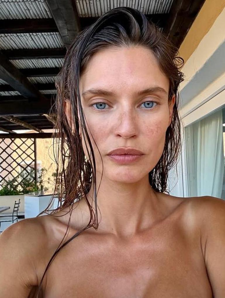 Kanserle mücadele eden eski Victoria's Secret modeline şirketten şoke eden cevap! Dünya konuşuyor