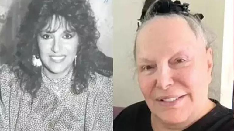 Ruhsar'ın Gözüm ablasıydı! Tuluğ Çizgen’in son hali sevenlerini üzdü