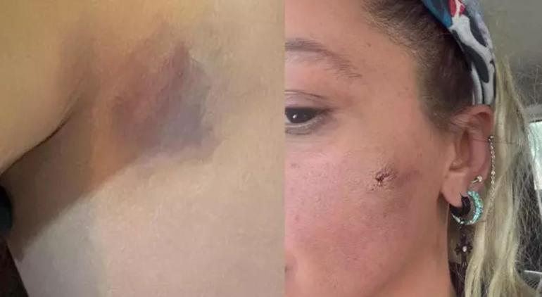 Şiddet gördüğünü açıklamıştı! Yıldız Asyalı'dan yeni paylaşım: Ben canımdan korkuyorum