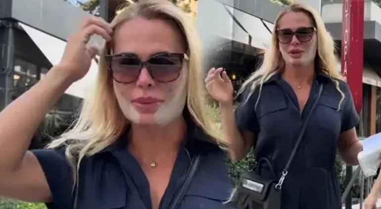 Yarışma sonrası estetik yaptırmıştı! Survivor 2026 ikincisi Nagihan Karadere son halini paylaştı
