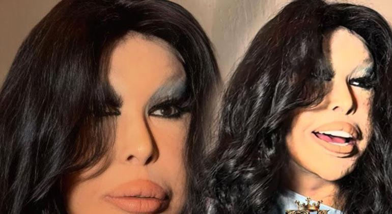 'Lolita Lift' operasyonu yaptırmıştı! Bülent Ersoy estetik sonrası sahnede: ‘Doktoruma kendimi emanet ettim’